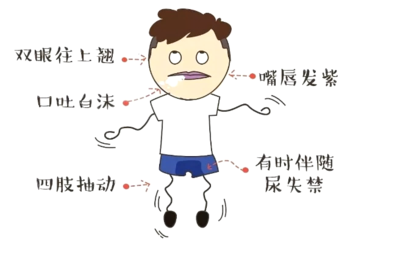 被封控在家,癫痫病患及家属如何自我管理?