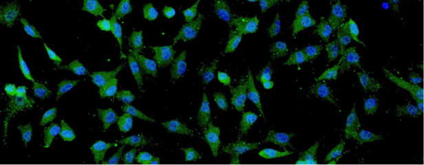 细胞外囊泡疗法 癫痫治疗的新希望